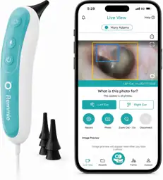 Remmie 4 Digital Otoscope, FDA-Registered… — Photo 1