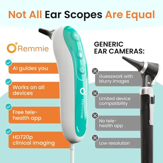 Remmie 4 Digital Otoscope, FDA-Registered… — Photo 3