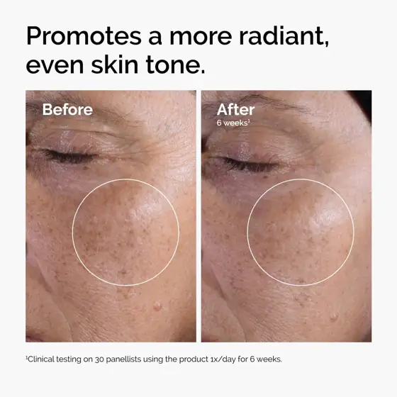 The Ordinary Glycolic Acid 7%… — Photo 2