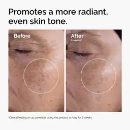 The Ordinary Glycolic Acid 7%… — Photo 2