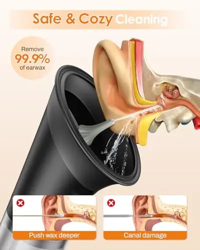 Electric Ear Wax Removal with… — Photo 2