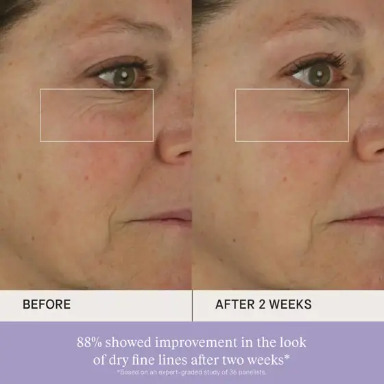 Tatcha The Dewy Skin Cream… — Photo 1