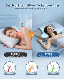 Cervical Neck Pillow for Pain… — Photo 2