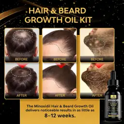 Beaueli Minoxidil Beard Growth Kit… — Photo 2